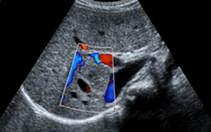 MyConciergeMD | Liver Ultrasound Scan