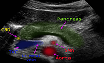 Pancreas Ultrasound | My Concierge MD in Beverly Hills