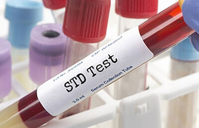 STD Testing Los Angeles | My Concierge MD in Beverly Hills