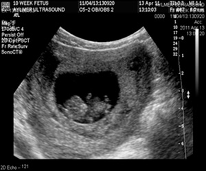 Baby Ultrasound Los Angeles | Best Baby Sonogram Beverly Hills