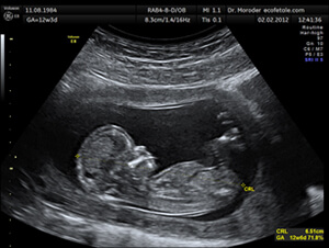 MyConciergeMD | Baby Ultrasound