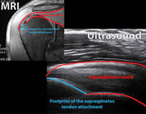 MyConciergeMD | Musculosketal Ultrasound