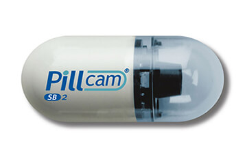 MyConciergeMD | Capsule Endoscopy | Wireless Pillcam Procedure