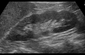 MyConciergeMD | Bladder Ultrasound and Renal Ultrasound