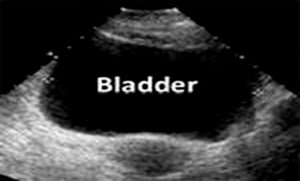 MyConciergeMD | Bladder Ultrasound and Renal Ultrasound