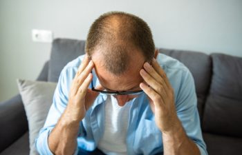 Bald patches on the head of a young man. The concept of the increased hormone dihydrotestosterone. Weakening of hair follicles
