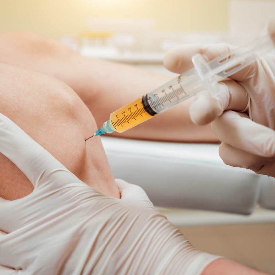 Platelet-rich plasma injection of the knee