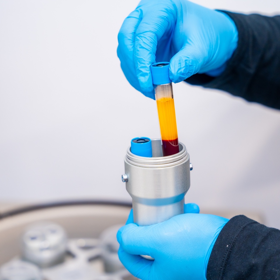 Close-up of the hands of a technician holding samples of blue next to centrifuge machine