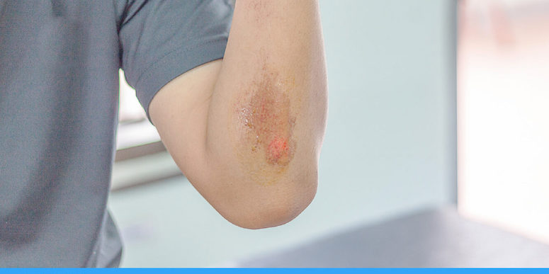MyConciergeMD | What Are The Difference Between Abrasion VS. Laceration?