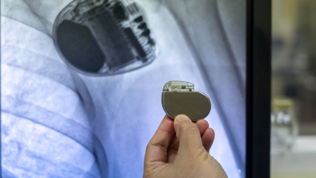 Living With A Pacemaker Can You Sunbathe With A Pacemaker?