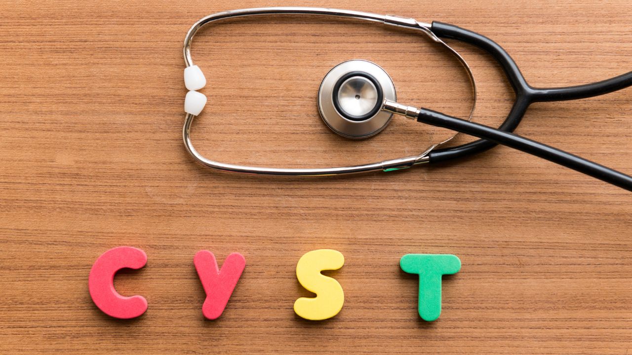 Cyst Removal - MY CONCIERGE MD