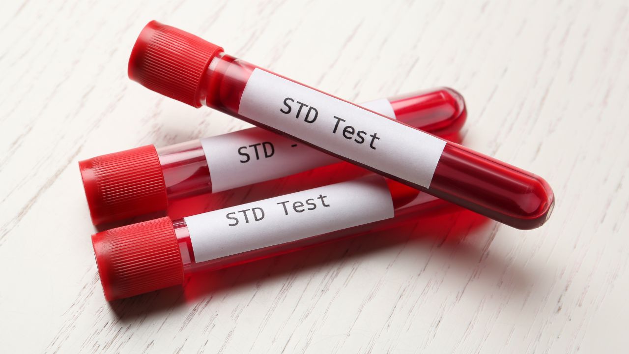 How Are STD Tests Done - MY CONCIERGE MD