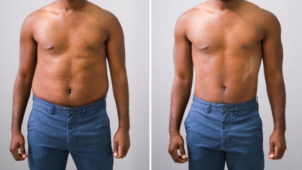 Topamax Weight Loss [Adverse Side Effects and Alternatives]