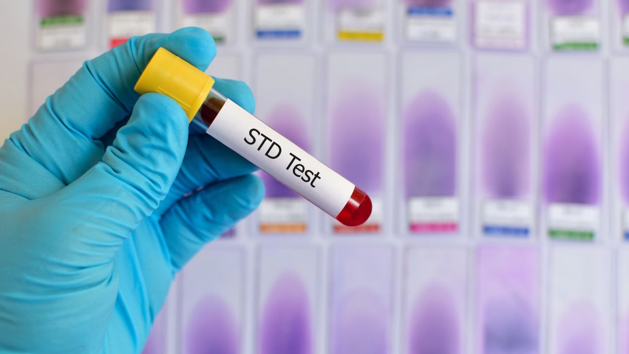 STD Testing - MY CONCIERGE MD